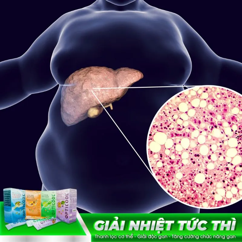 9 cách giải độc gan tại nhà hiệu quả